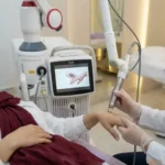جوانسازی دست با لیزر فوتونا در مشهد