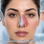چرا یک طرف بینی بعد از عمل بیشتر ورم می‌کند؟